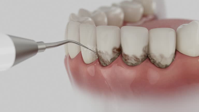 Reliable Tooth Extraction contractor in Oxford County County, ME by Dentist Open Now